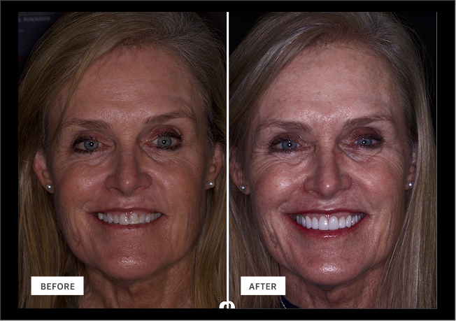 Smile Gallery | Woodlands Family Dental